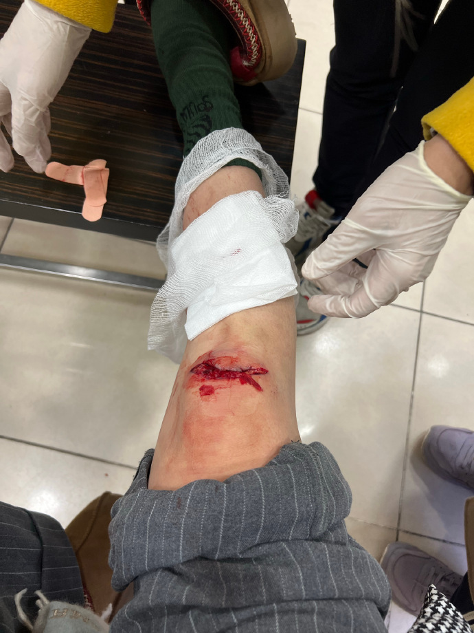 开云中国-马赛队球员名单